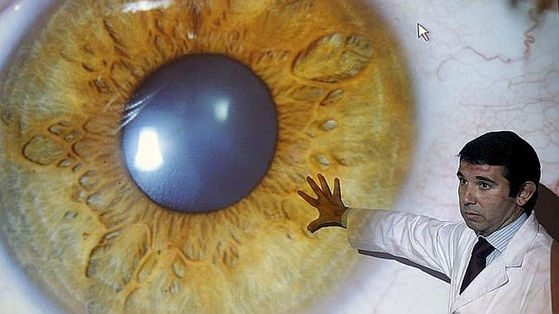 El ojo podría proporcionar una 'ventana al cerebro' después de sufrir un accidente cerebrovascular