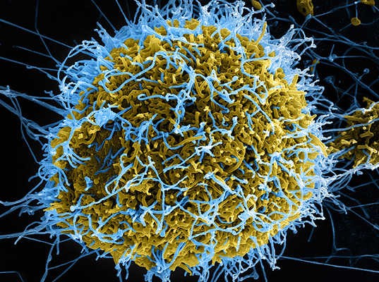 Un virus gigante pudo jugar un intrigante papel en la evolución

