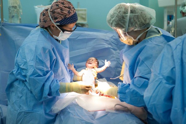 La OMS recomienda más tiempo para dar a luz, menos médicos y más decisiones durante el parto

