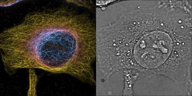 Desarrollan un microscopio de superresolución 4D, que ve en espacio y tiempo

