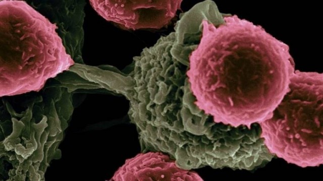 Vinculan la contaminación del agua potable con tóxicos a unos tipos de cánceres raros
