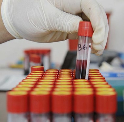 Reconstruyen la historia evolutiva del sida, la hepatitis y la gripe con un modelo matemático

