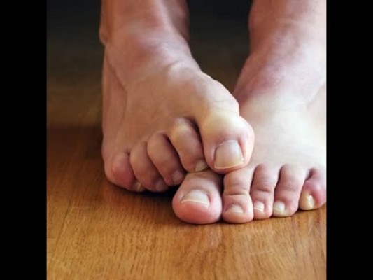 Un 20% de la población padece mal olor de pies por mala alimentación o calzado sintético