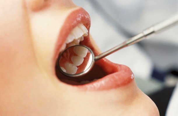 Los medicamentos que se emplean para el tratamiento de la epilepsia provocan gingivitis