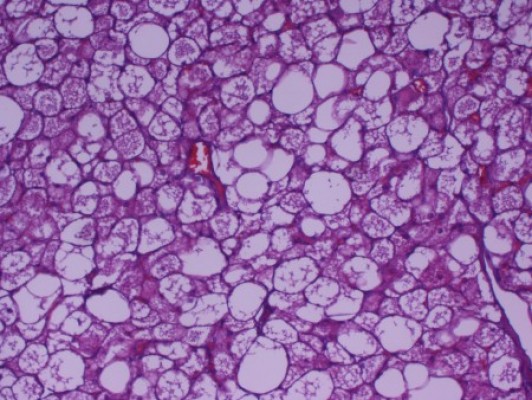 La 'grasa parda' calienta el cuerpo de madrugada