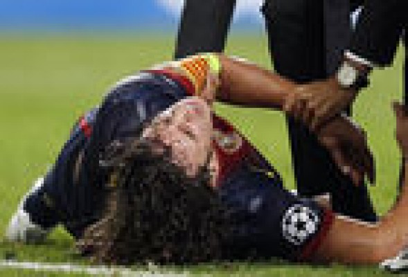 Puyol sufre una rotura en su codo izquierdo 