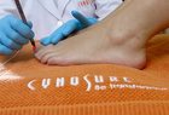 Suávitas firma un acuerdo con el gigante Cynosure para incorporar tecnología láser