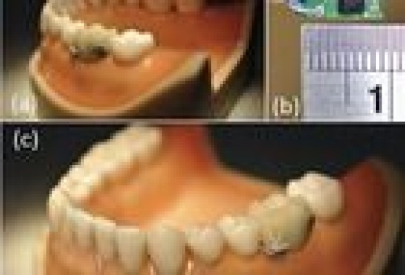 Un sensor dental avisa si comes o fumas demasiado