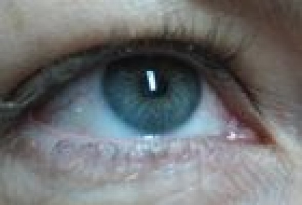 Desarrollan un 'software' que analiza imágenes de la retina para detectar enfermedades