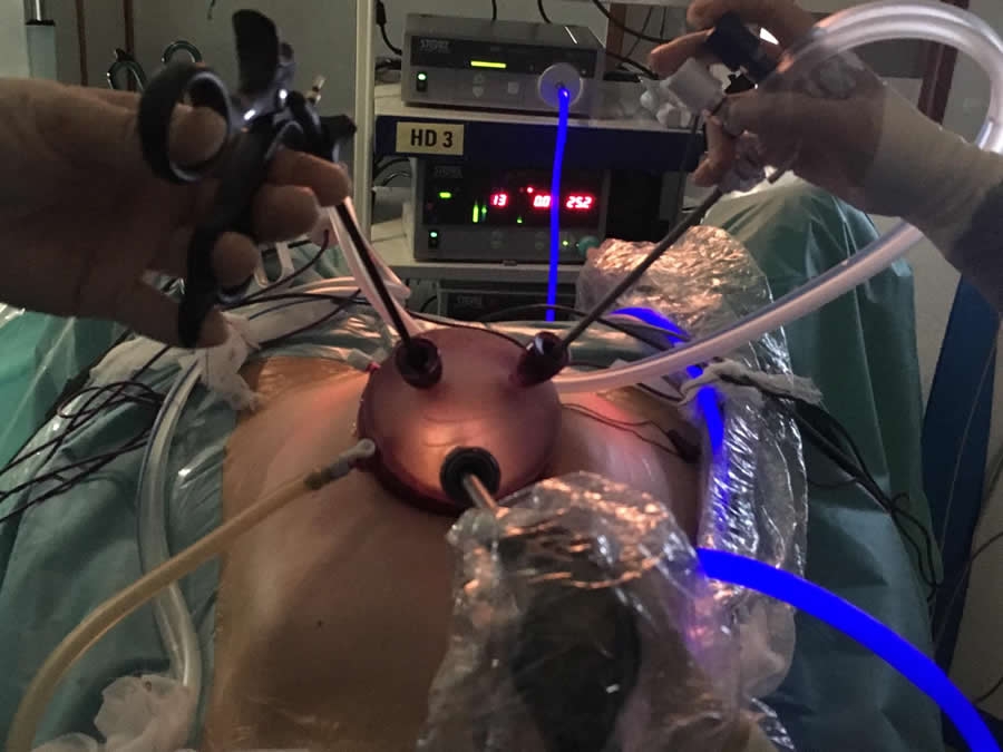 Llega a Castellón una nueva técnica ginecológica que reduce un 40% el tiempo de hospitalización