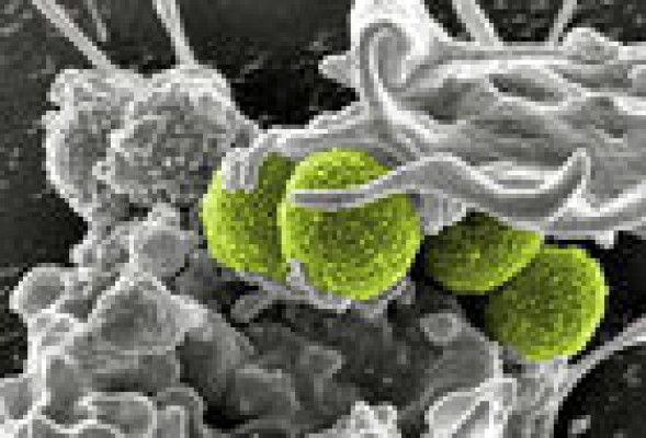 Bionaturis lanza un 'profit warning' y se hunde un 30% en el MAB