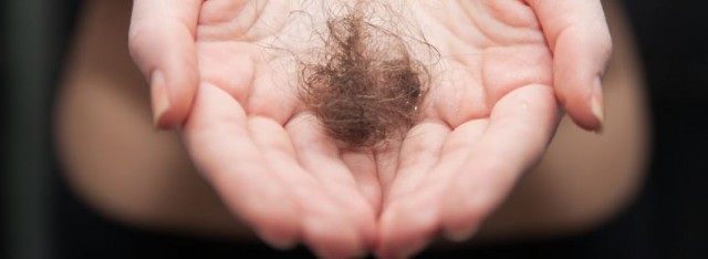 El diagnóstico y tratamiento precoz de la alopecia consigue estabilizar la pérdida de cabello en nueve de cada diez casos 
