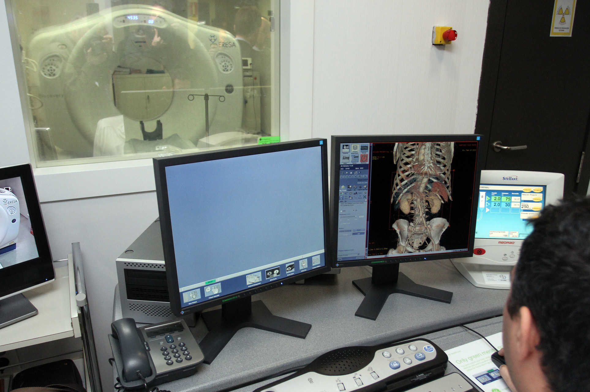Los radiólogos mantienen el plante a Sanidad por el retraso en la reversión de las resonancias