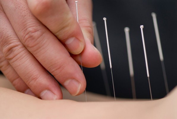 Acupuntura para aliviar los sofocos de las mujeres con cáncer de mama