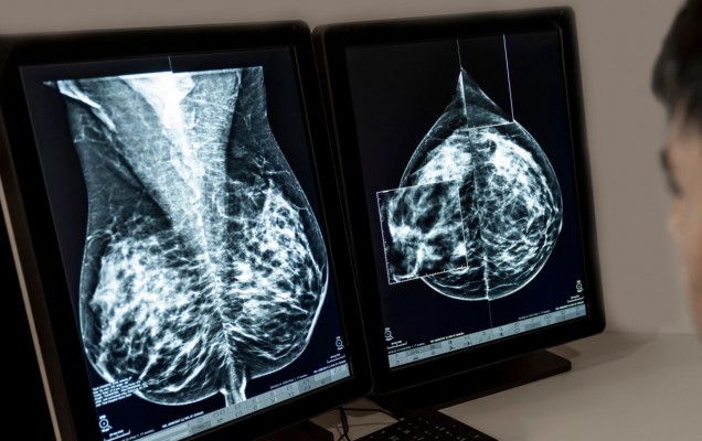 La Comisión Europea aprueba Kisqali de Novartis para pacientes con cáncer de mama localizado HR+/HER2- con alto riesgo de recaída
