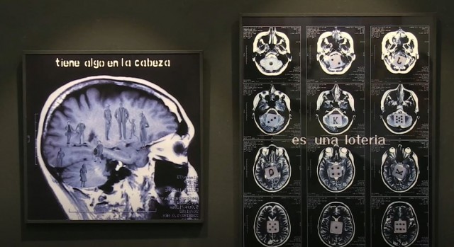 'Afección', la instalación que reflexiona con radiografías y vídeos caseros sobre la enfermedad y la familia