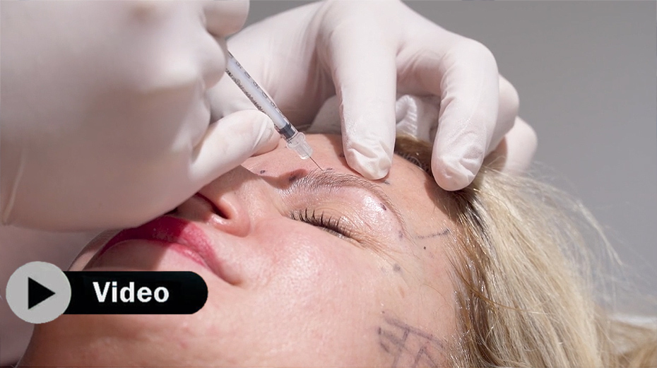 Antiaging o cómo devolverle al rostro la juventud perdida  