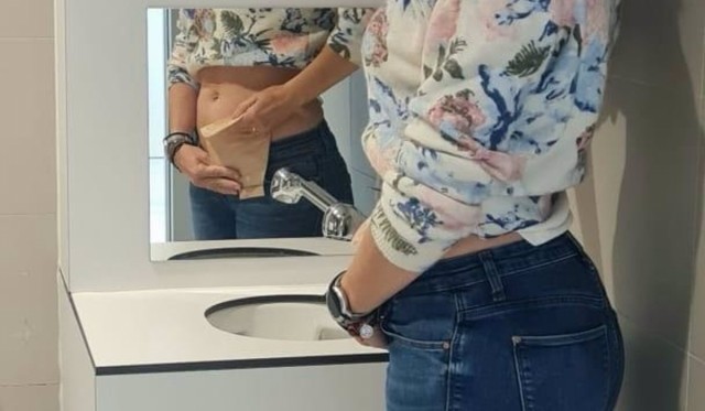 El hospital de Yecla instala un segundo aseo adaptado para pacientes ostomizados