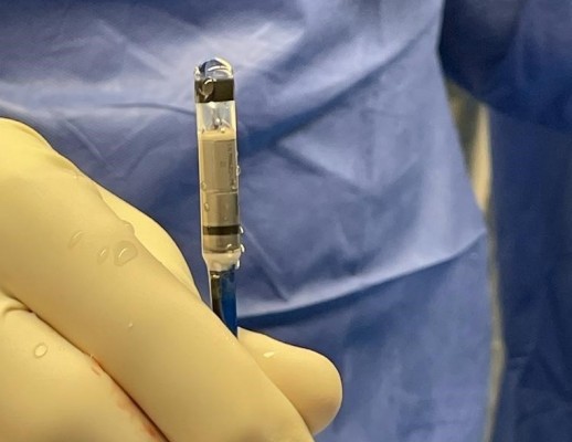 El hospital del Vinalopó implanta el primer marcapasos sin cables MICRA AV2 de la provincia 