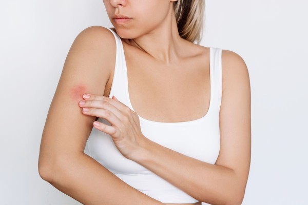 Novartis lanza una campaña para visibilizar la Hidradenitis Supurativa, que tarda en diagnosticarse una media de 10 años