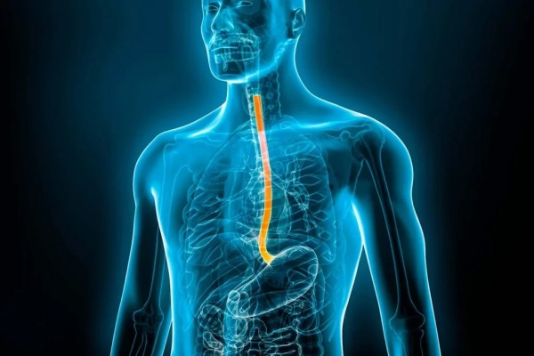 Proclaman el Día Mundial de la Esofagitis Eosinofílica, una enfermedad que dificulta comer o beber