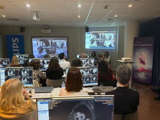 El Hospital Doctor Balmis se consolida como referente nacional en resonancia magnética cardíaca, con más de 1.600 estudios anuales 