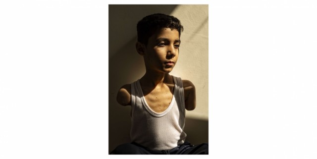 La imagen de un niño mutilado en un ataque en Gaza, foto del año del World Press Photo 2025