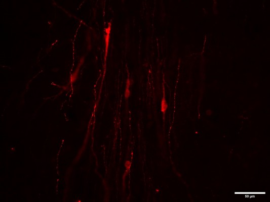 La UV investiga la relación entre trastornos del neurodesarrollo y alteraciones de la pubertad