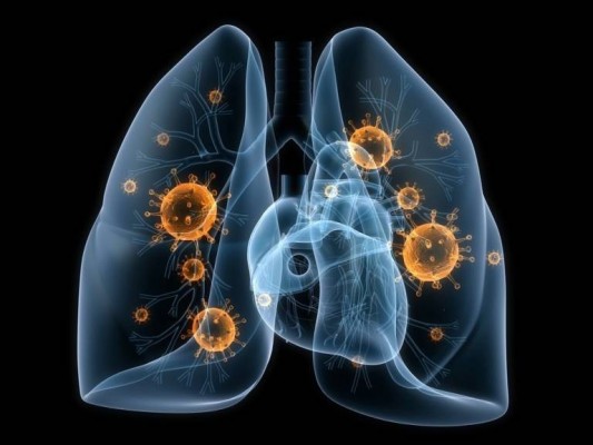 Demuestran la eficacia de un nuevo medicamento en una variación resistente de cáncer de pulmón