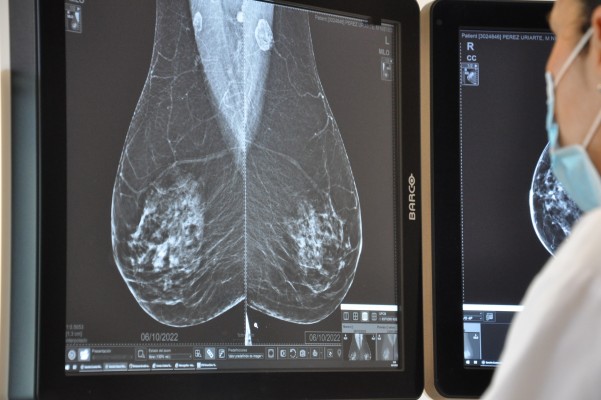 Sanidad adquiere diez nuevos mamógrafos para mejorar la prevención del cáncer de mama