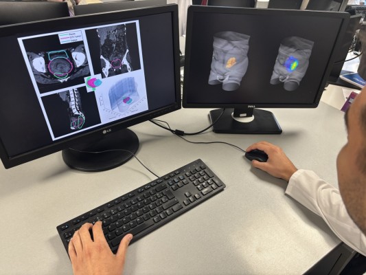 'Lattice', el proyecto que combate las células tumorales del cáncer con fondos de Ivace+i