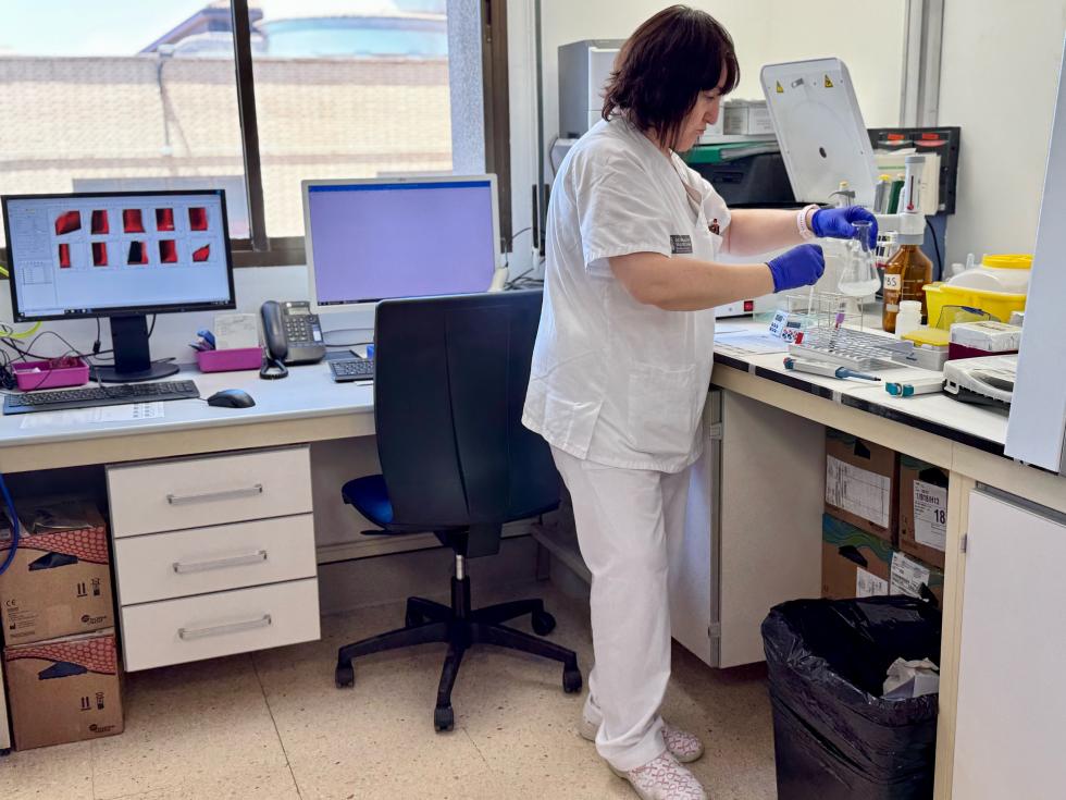 Premian un innovador proyecto del Hospital Doctor Peset que estudia cómo los linfomas B afectan al sistema inmunitario - 