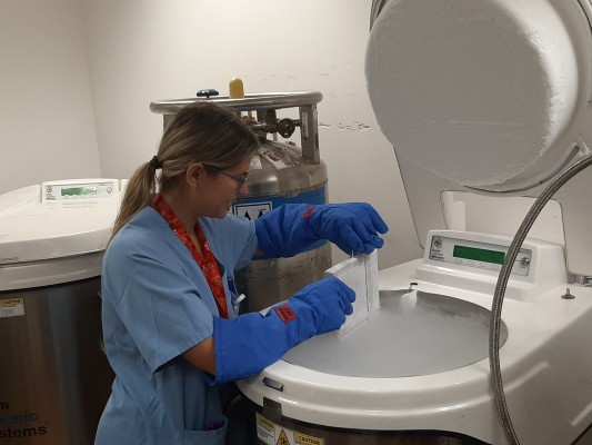 El Hospital Clínico supera el centenar de pacientes de leucemia tratados con CAR-T