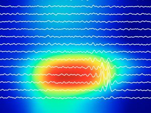 El Grupo Español de Investigación en Neurooncología celebra el XVII Simposio Geino los días 28 y 29 de octubre en Madrid