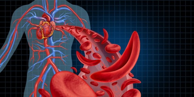 Más casos de anemia: nuestra salud no es de hierro