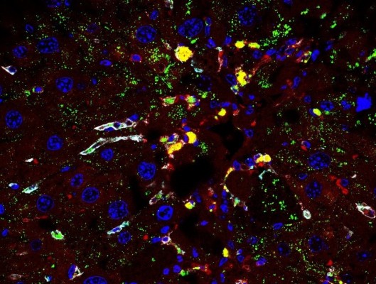 Una investigación identifica el papel de una proteína celular en la remisión de la fibrosis