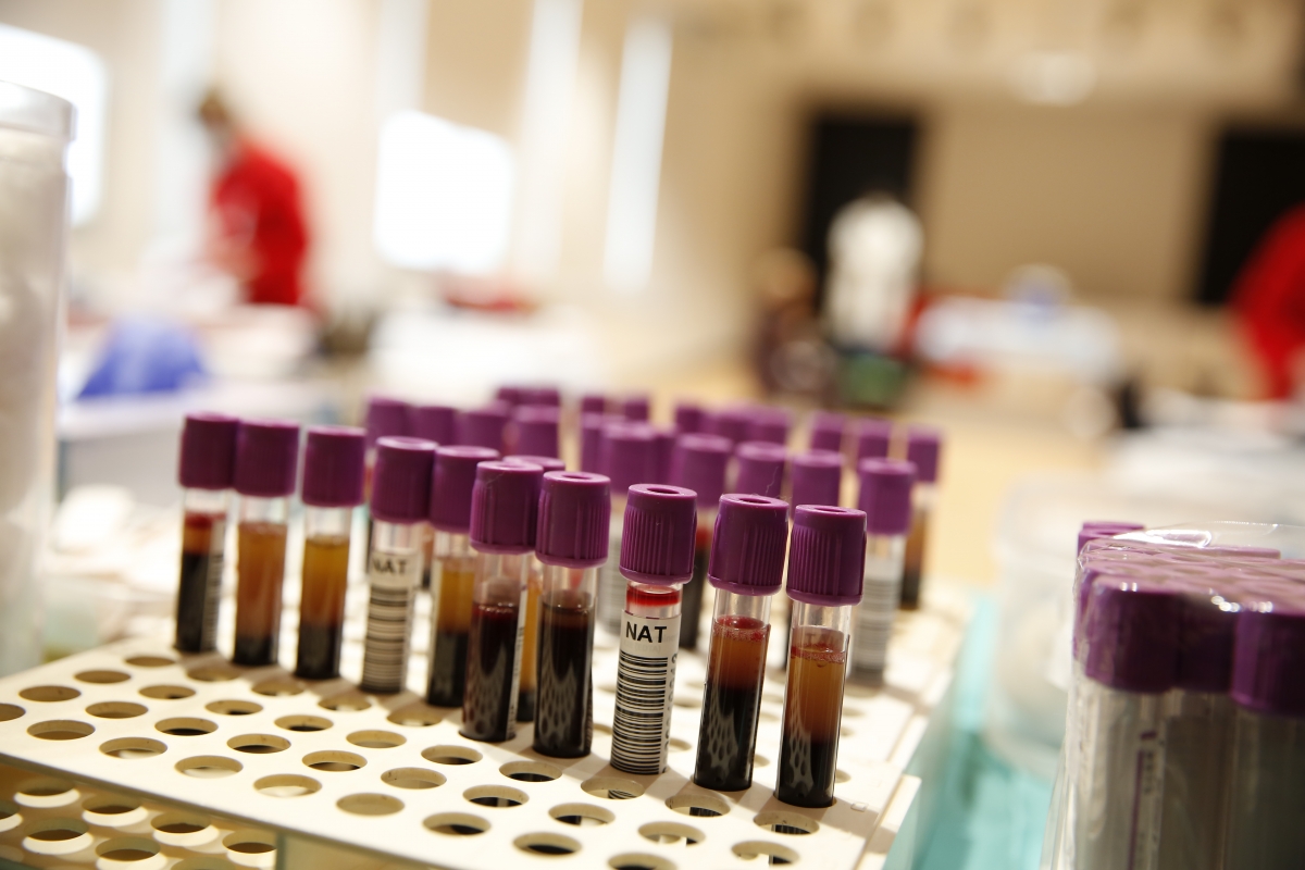 Castellón suma 851 nuevos donantes de médula ósea desde 2021 y 168 hasta el mes de septiembre