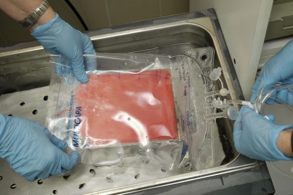 La Comunitat tiene 42.000 donantes de médula ósea y 5.000 unidades de cordón umbilical