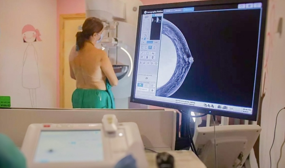 Sanidad se compromete a dar los resultados de mamografías del programa de cribado de cáncer en un máximo de 30 días