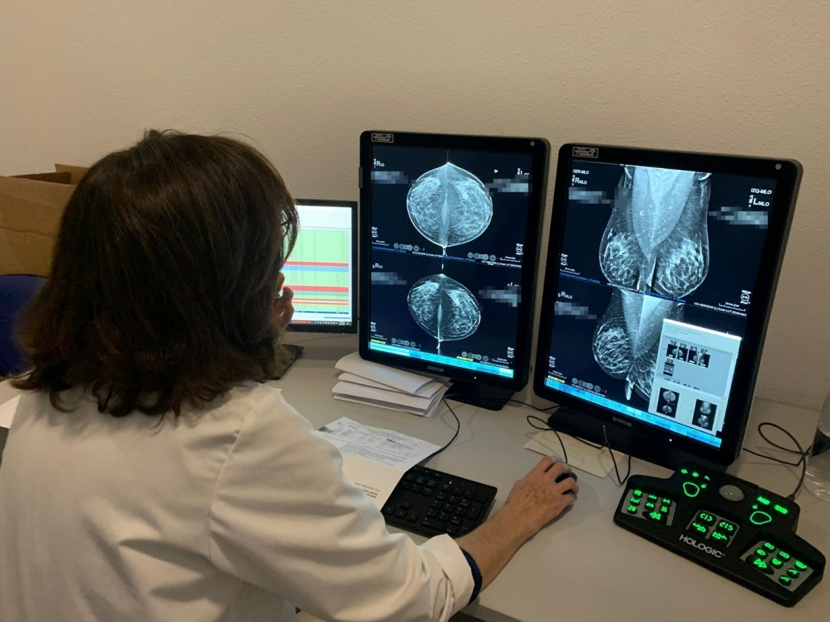 Sanidad financia un nuevo equipamiento de alto rendimiento para impulsar la investigación en cáncer de mama