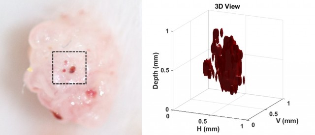 Obtienen las primeras imágenes en 3D de un melanoma en ratones con microscopio fotoacústico de bajo coste