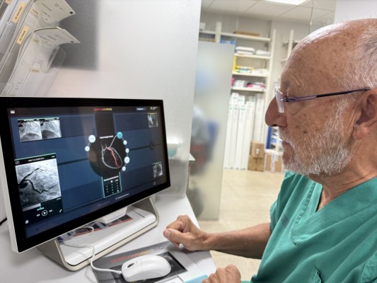 El hospital de La Ribera incorpora una innovadora tecnología para el diagnóstico no invasivo de lesiones coronarias