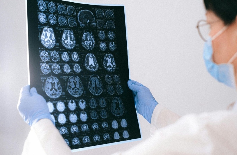 Qué es la neuralgia del trigémino y cómo se trata: consejos del especialista Juan Fernando García Henares