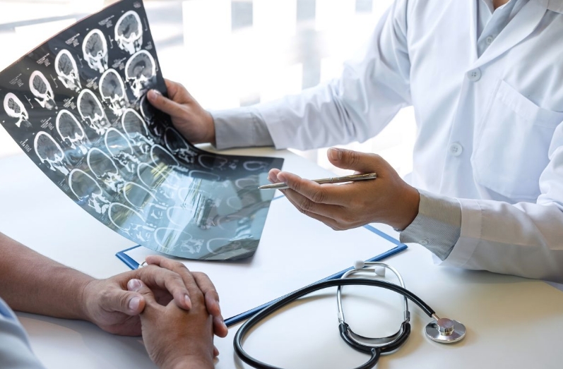 Más de la mitad de los neurólogos observa crisis ocultas en pacientes con epilepsia supuestamente controlada