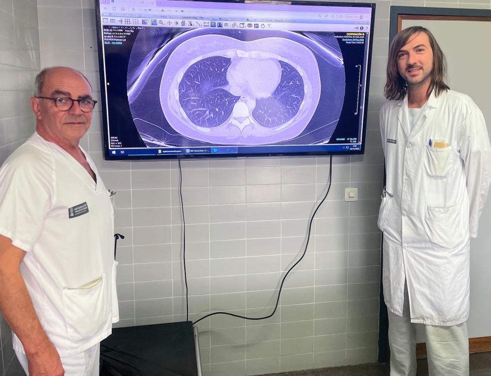 El Hospital Sant Joan desarrolla una IA que predice la respuesta al tratamiento biológico del asma grave y permite la lectura de los TAC de tórax