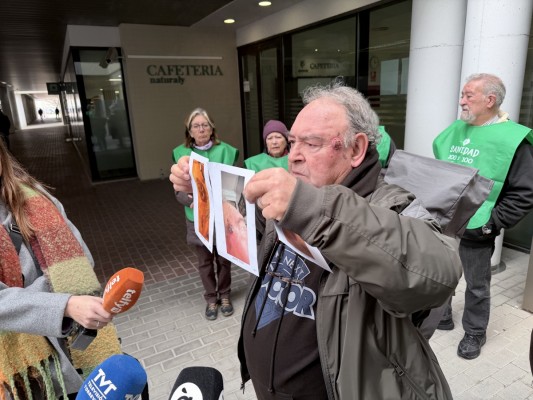 Más de cinco meses para un posible carcinoma y derivaciones a Ribera: la situación de Dermatología en Torrevieja