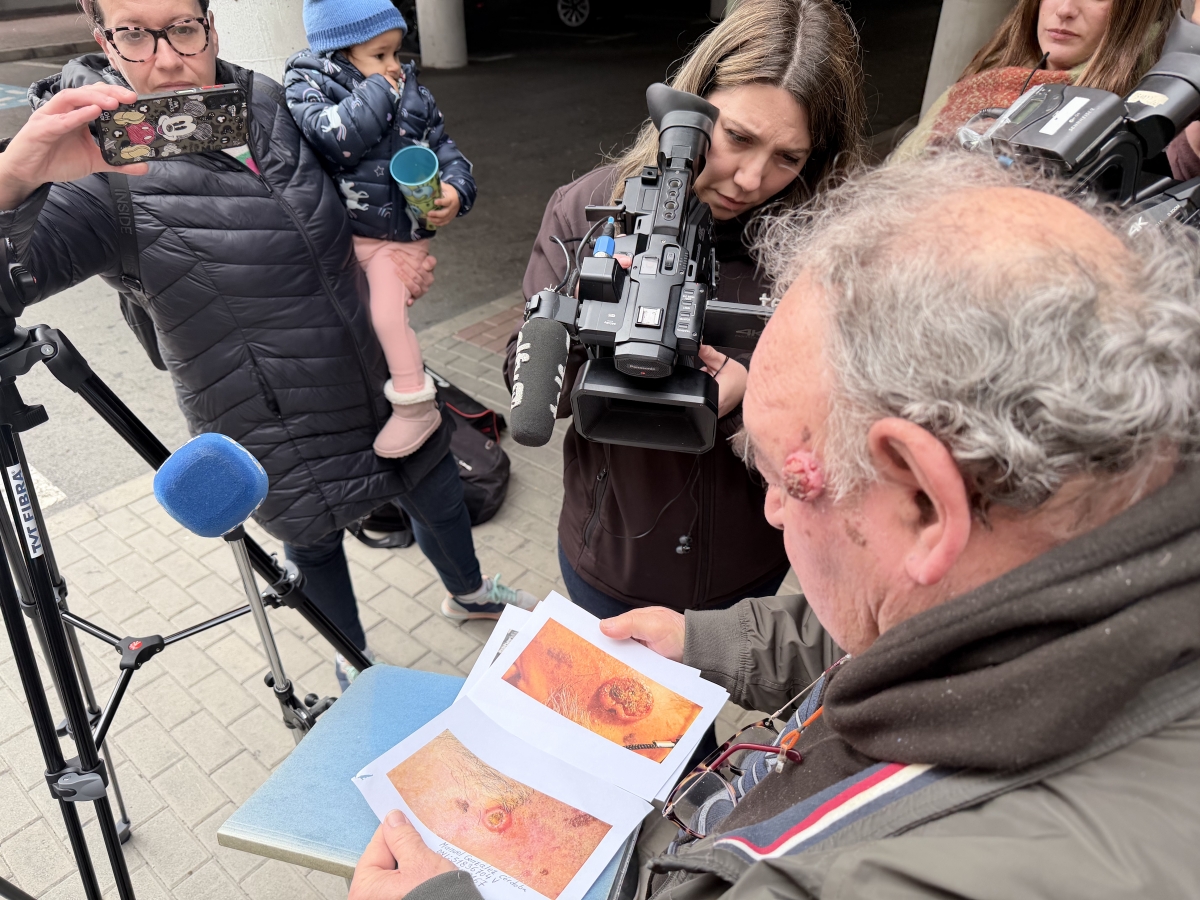 Manuel González muestra las imágenes de la evolución de la lesión que arrastra desde el verano. - Foto: IJ. Manuel González muestra las imágenes de la evolución de la lesión que arrastra desde el verano.