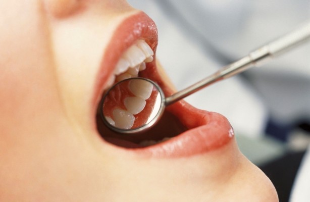 ¿Son seguros los implantes dentales?
