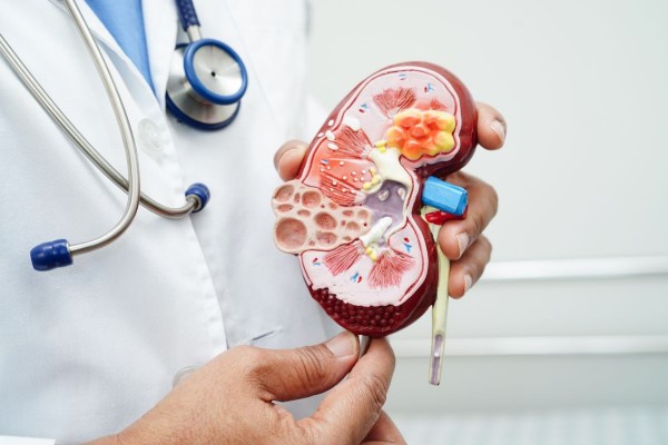 Los Hospitales de Quirónsalud integrados en el Sermas detectaron 424 nuevos casos de enfermedad renal crónica en 2025