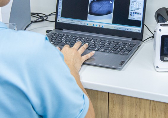 Sanidad renueva el equipamiento de las unidades de hospitalización a domicilio con 350 nuevos portátiles